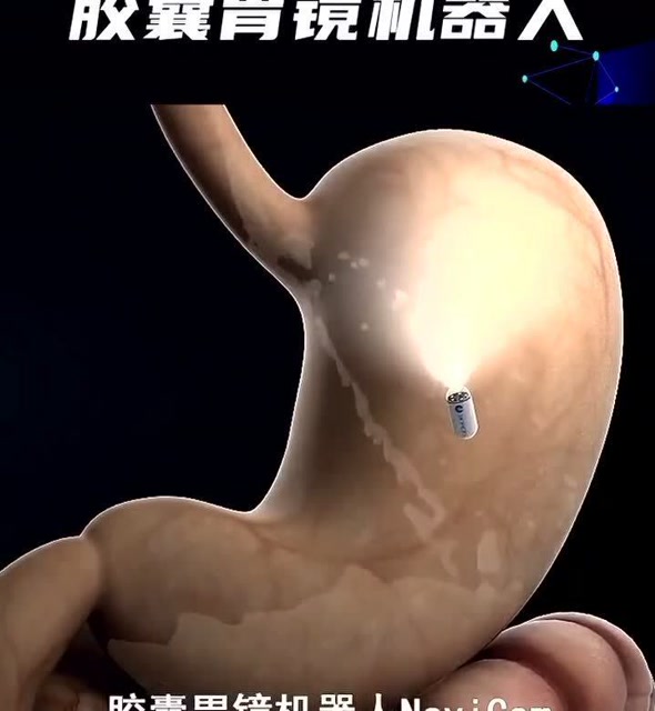 胶囊胃镜机器人