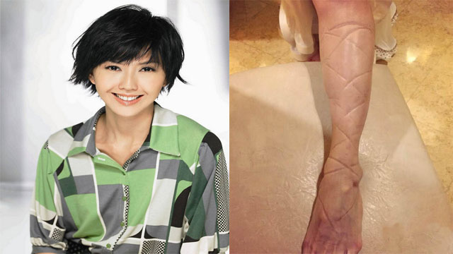 爱美的代价 孙燕姿为穿美鞋小脚布满勒痕