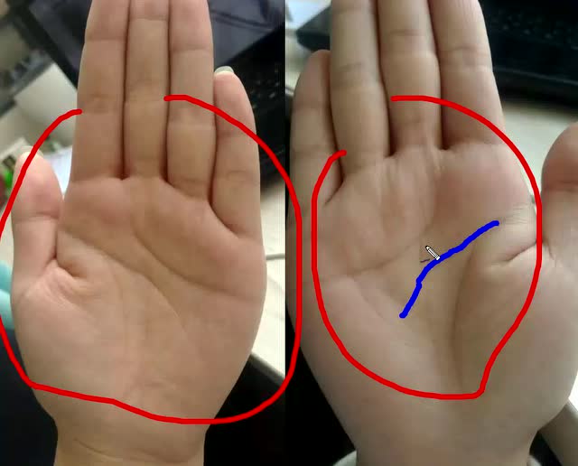 智慧线断裂,学业不好,婚姻出问题