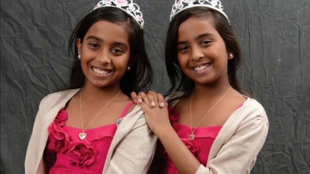 世界上最幸运的连体姐妹花,出生时共用肝脏,如今都是学霸!