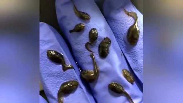 野外抓来的蝌蚪,显微镜下看到的一幕,怪不得那么多传染病