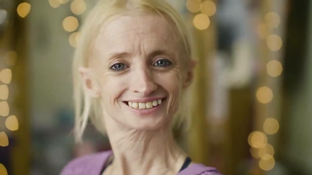 美国女子患有早衰症,剥夺了她的青春,却活出了不一样的人生