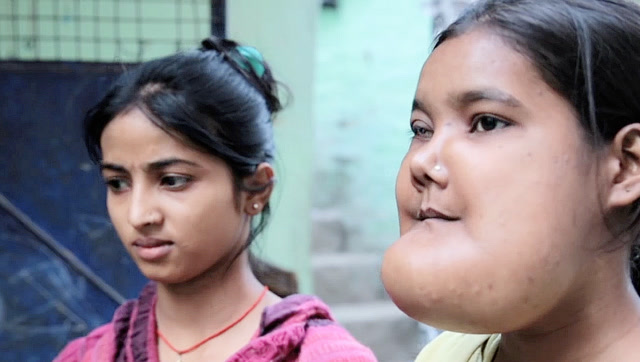 自卑的大下巴女孩,渴望结婚但没人愿意娶