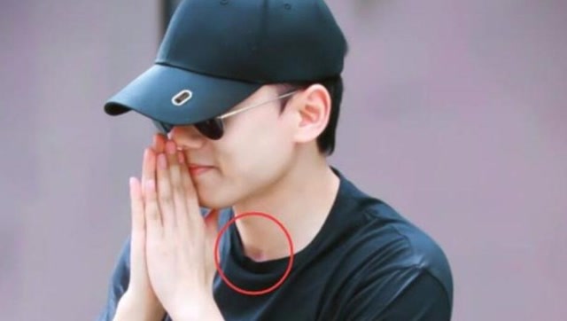 张杰录制快本照曝光,看到脖子上的草莓网友瞬间炸锅:是谢娜弄的吗