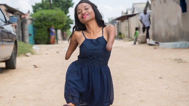 生在最贫穷国家,生来没有手脚,都没阻止她考上大学改变未来