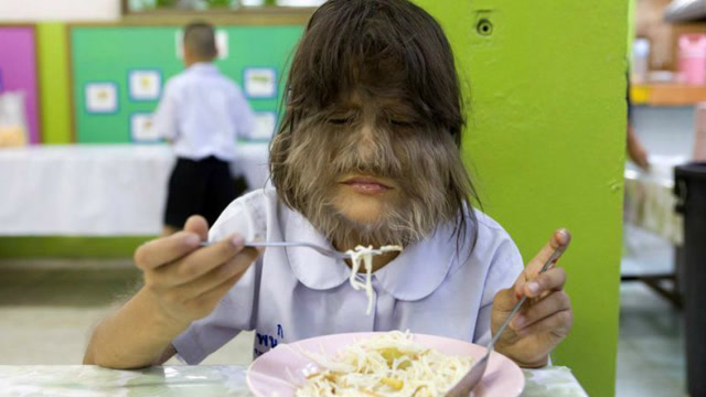 世界上体毛最长的人,浑身都是头发,返祖现象严重!