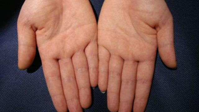 女人手要柴,富贵又延年?