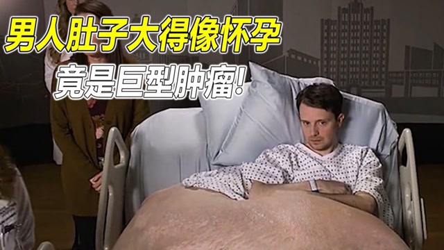 男人肚子大得像怀孕检查发现竟是巨型肿瘤