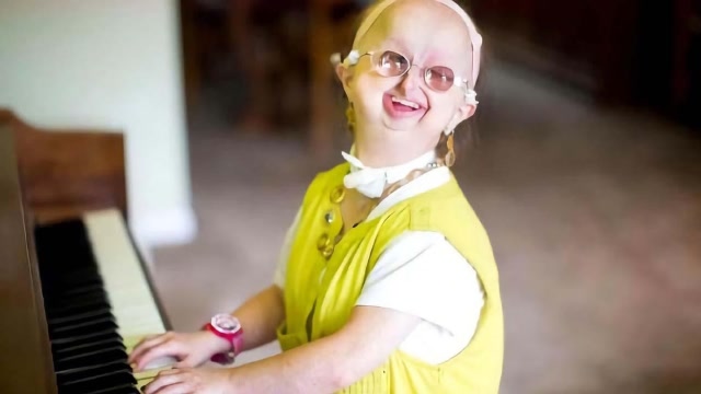 20岁少女却长得像小孩,美国女孩患罕见怪病,需要别人24小时照顾!