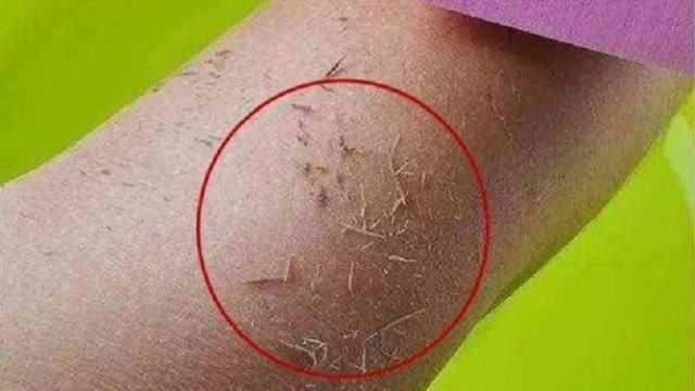 洗澡搓下来的是"泥"还是皮?很多人不知道,还敢乱搓!