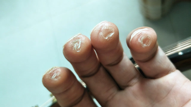 "弹废"手指茧子厚,只有不会弹的人才这样么?大师的手不会这样的?