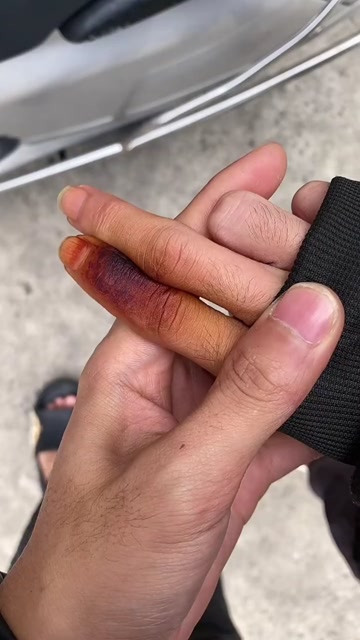 孩子说他不吸烟,看到他的手,我应该相信他的话吗?