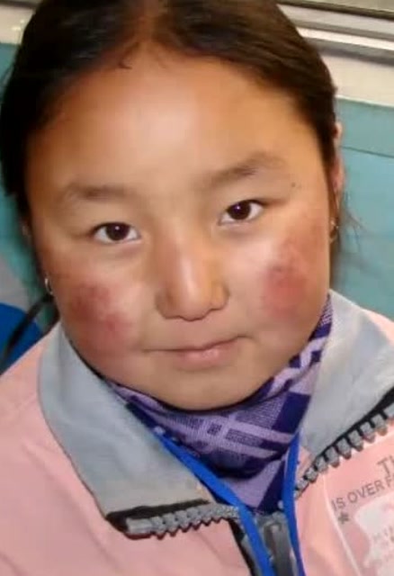 曾经是脸有高原红的胖姑娘,接下来,让你看看什么叫逆袭!