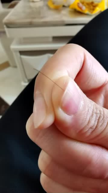 抓了两下头皮,一根头发扎进了我的手指,拔出来会出血的那种!