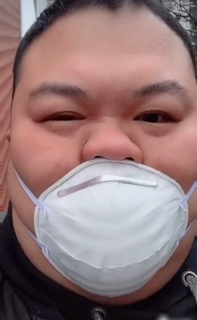 胖小伙跪求厂家出大号口罩,脸被口罩绑出3层:不能张嘴呼吸