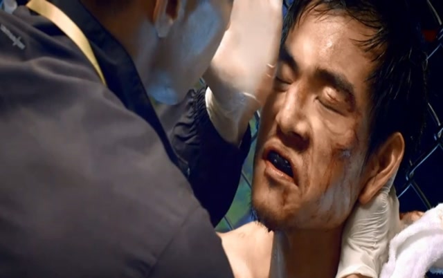 拳手比赛鼻子被打歪,怎料师傅一招治好,隔着屏幕看着都疼啊!