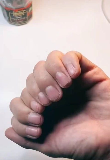 一只手长了八根手指头,神马情况了解下