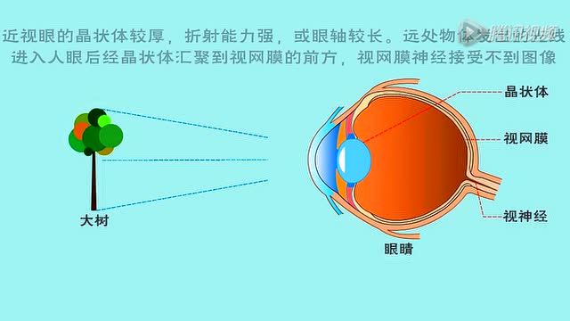 近视眼原理图