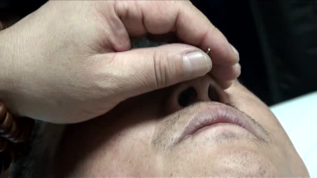 杜嵩:独针-降压针法操作演示