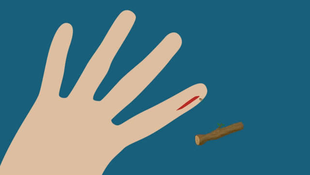 为什么纸能轻松划伤皮肤伤害比刀伤还大?看完解开我多年的疑惑!