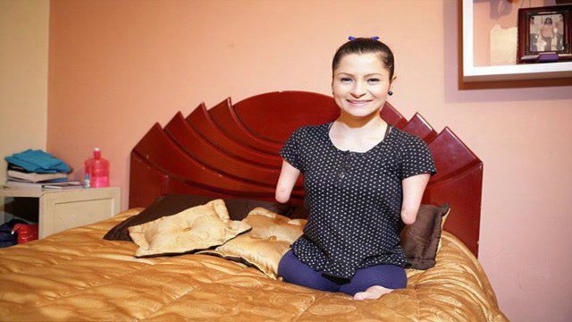 这是个没有四肢的女孩,却乐观善良,如今她过得怎样