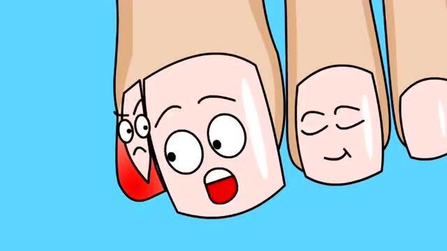 甲沟炎的罪魁火候直接用镊子把指甲拔出来3d动画演示整个过程