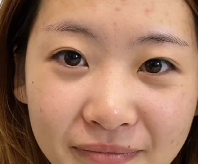 美女姐姐满脸青春痘太吓人了!经过明星化妆师的手艺简直是大逆袭啊!