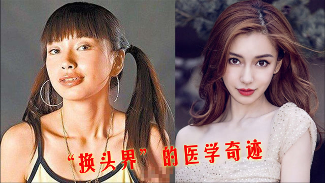 女星整容前后对比,杨颖蜕变成女神,四千年美女鞠婧祎也是"换头"girl