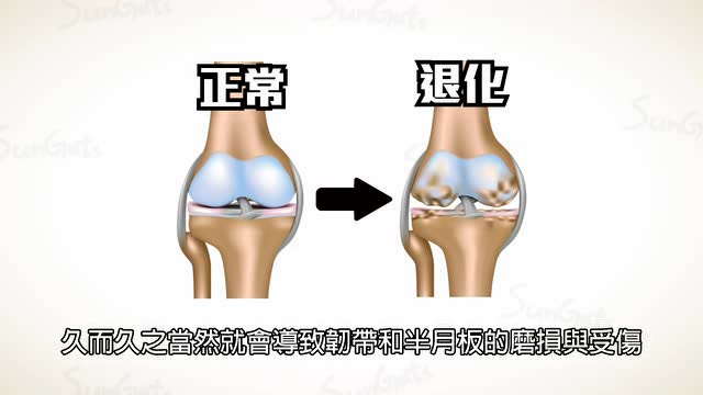 什么是膝盖退化?
