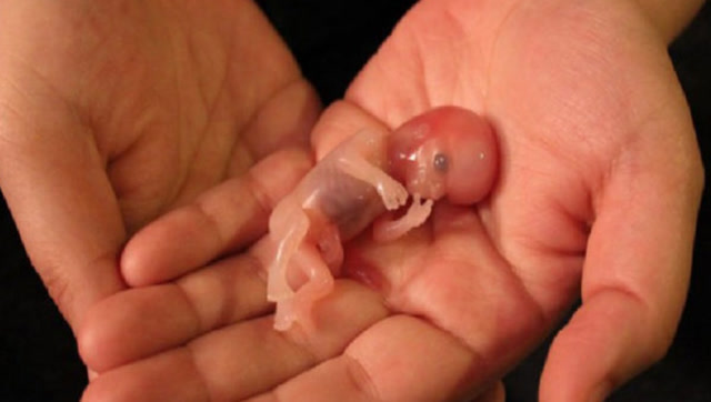 手术人流后,被遗弃的婴儿都去了哪里,看完心酸酸!