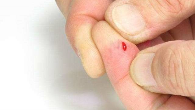 手指扎刺,用针挑不出来还很疼,教你简单一招,让它自己跑出来