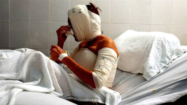 少女被出轨,脸上割了108刀,解下绷带后,在场众人被吓坏了