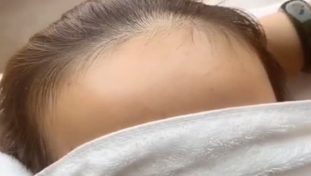 这脑门大的,发烧都要贴两块退烧贴,穿到清朝能当阿哥了!