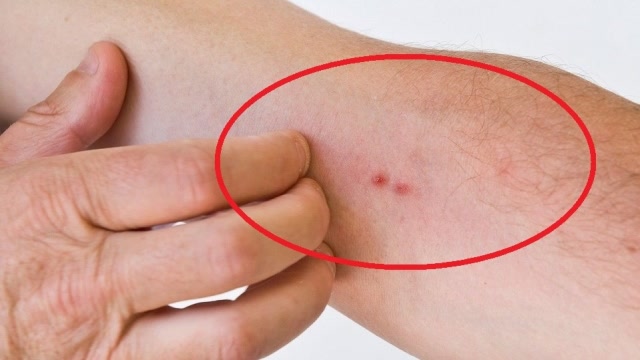 医生告诫:肝癌前期有提醒,若这三个地方发痒,一定要重视!