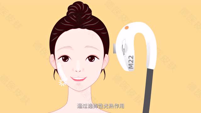 光子嫩肤治疗及术后护理0514