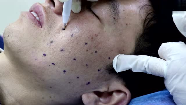 艾尚美cvogdsog熙笛雾化三线提升教学视频