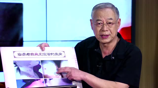 养生堂张书元白癜风区分与皮肤ct的应用