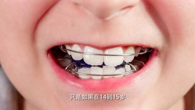 牙齿整齐,美丽加倍,几岁做牙齿矫正比较好呢?