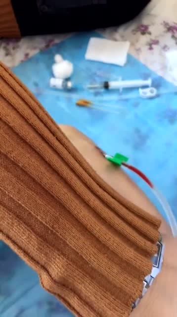 血透病房的护士小姐姐,面对这样粗的针管,看到就不想生病了