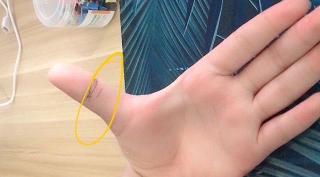 大拇指有凤眼纹的人天生就是菩萨心肠