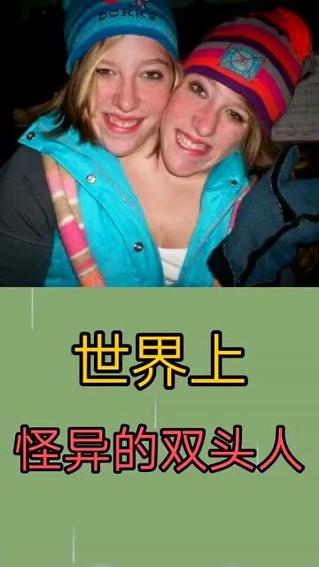 世界上怪异的双头人以后找对象怎么办