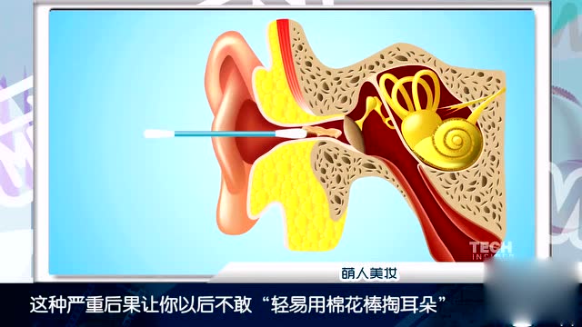 用棉花棒掏耳朵动态图,终于明白出不来的耳屎去了哪里