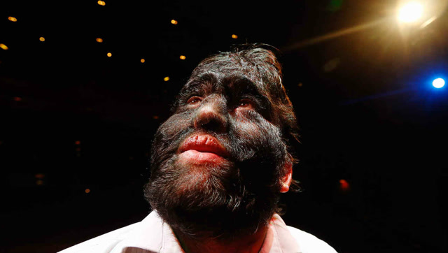 难道是西游记中的狮子精跑出来了?原来世上真的有狮面人