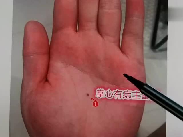 手心长痣意义非凡手上的痣是致富的象征