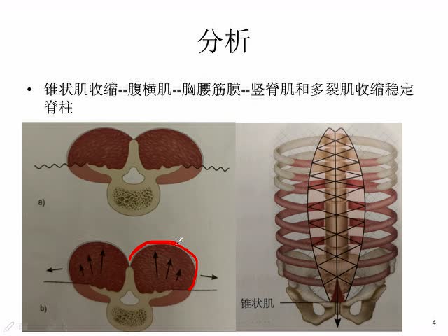 一块小肌(锥状肌)与腰痛