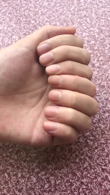 一只手有十个手指头?原来眼睛看到的不一定是真的.