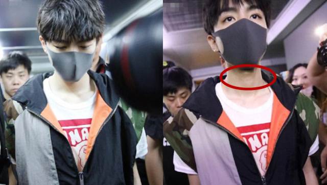 王俊凯现身却被脖子上的"痕迹"抢镜 网友:要注意身体