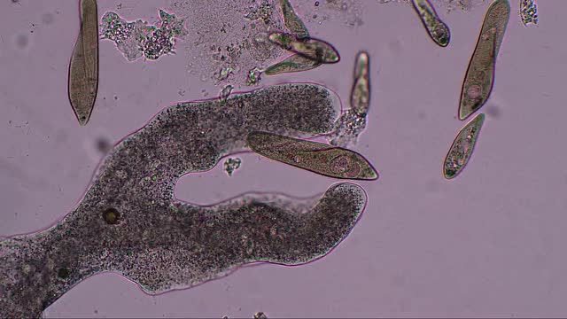 阿米巴捕食草履虫