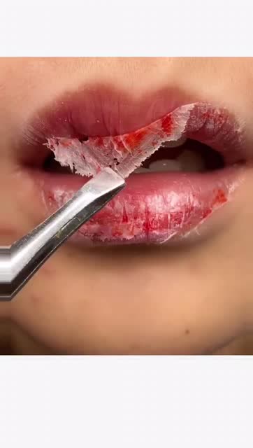 十天没喝水,嘴唇竟然直接能撕皮!