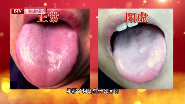 阳虚的九个典型症状，测试你是否阳虚症状阳虚舌苔红怎么办